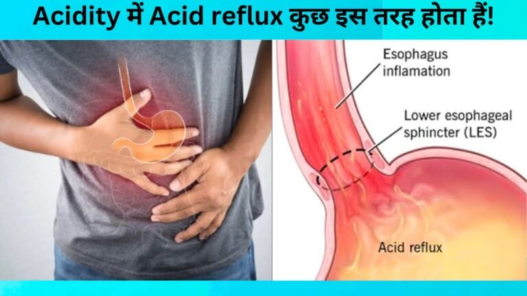 Acidity क्यों और कैसे होती है, कुछ बातों का रखेंगे ध्यान तो नहीं होगी यह समस्या!